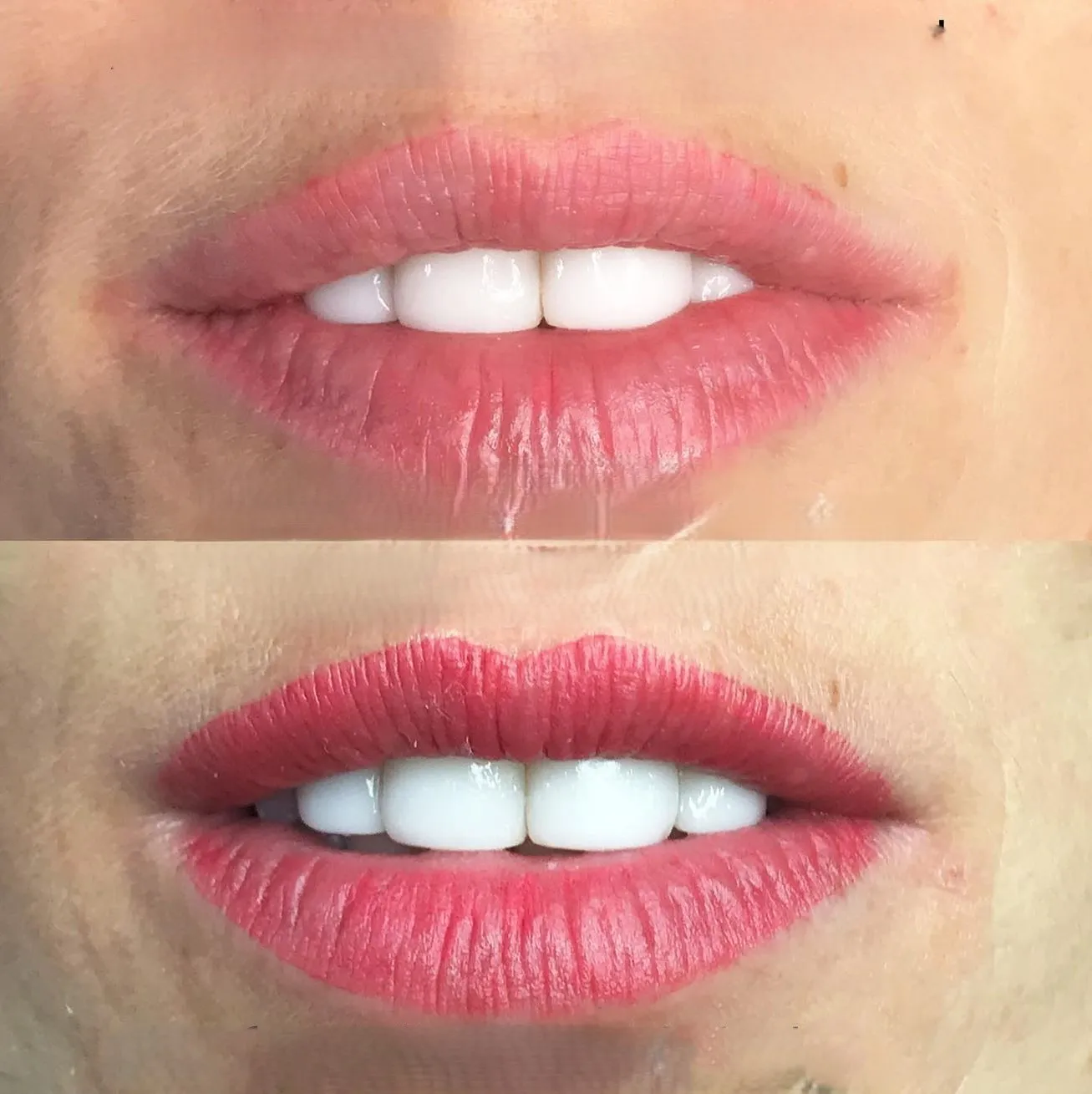 Colour Correction vs Re-Tattooing