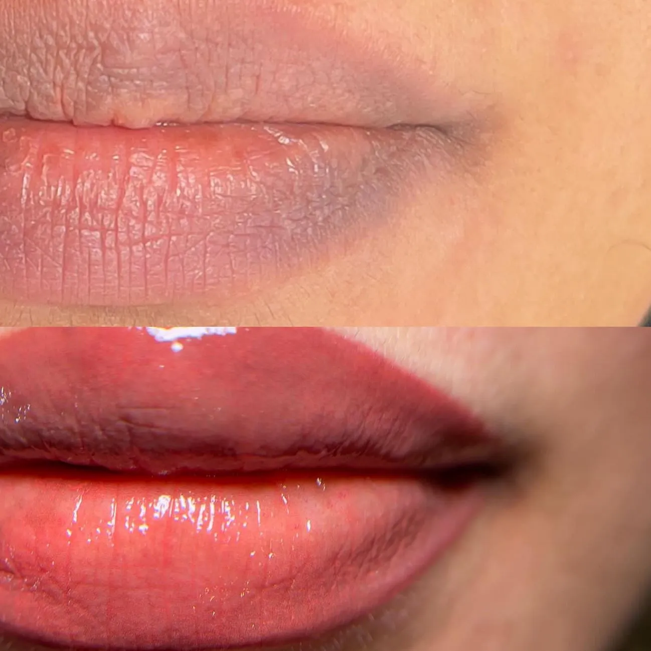 Common Concerns with Darker Lips (and Why They’re Normal)
