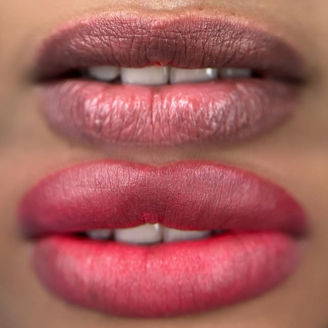 Healing Isn’t Linear — Especially for Melanin-Rich Lips