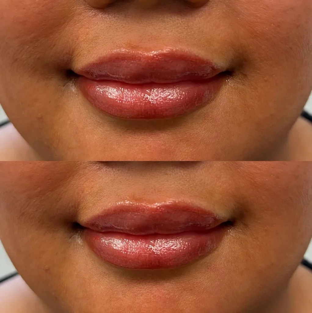 How Does the Healing Process Work for Dark Lip Tattooing