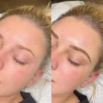 USCIS693 | How Can You Shower Without Getting Microbladed Eyebrows Wet? How Long Does Saline Tattoo Removal Take to Work