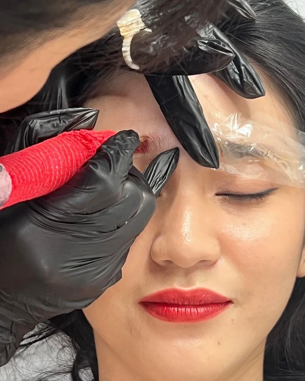 USCIS693 | How Long Does Saline Tattoo Removal Take to Work? How Many Sessions Will I Need