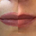 USCIS693 | How to Access Katherine Gorge: Your Ultimate Travel Guide How to Remove a Cosmetic Lip Tattoo